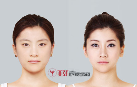 生态美鼻案例